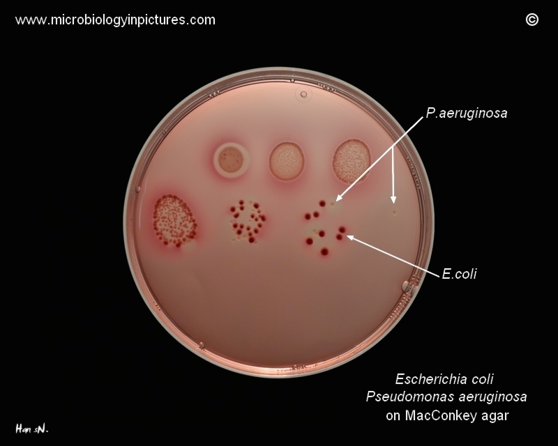 pseudomonas aeruginosa on macconkey agar