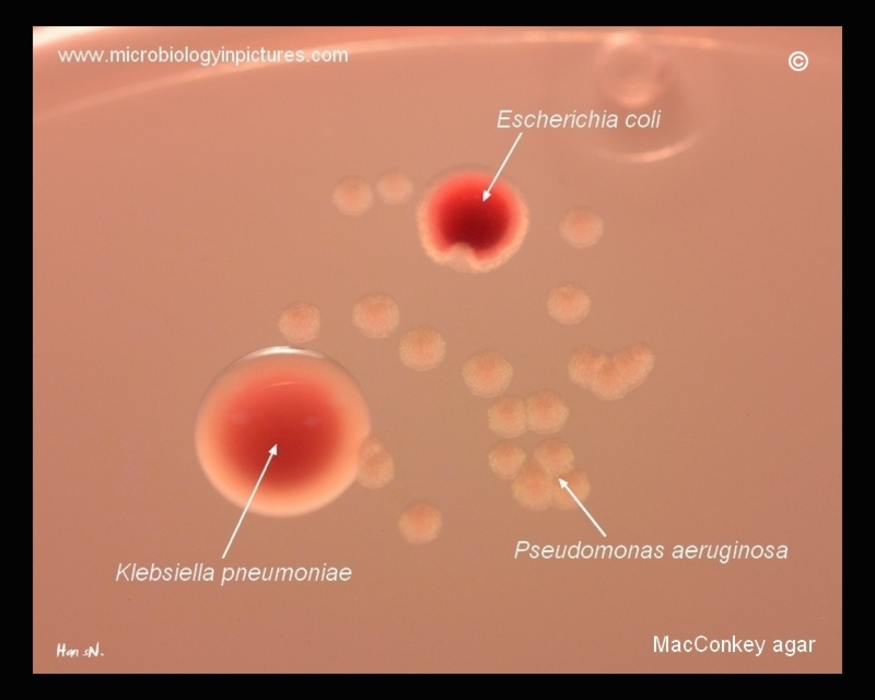 E.coli, Klebsiella, Pseudomonas