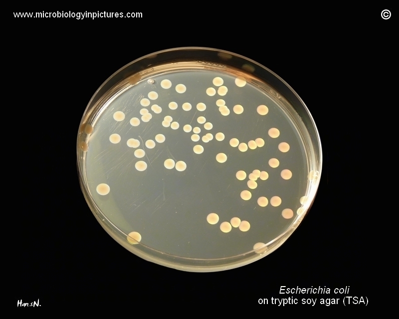 Petri dish, colonies on TSA