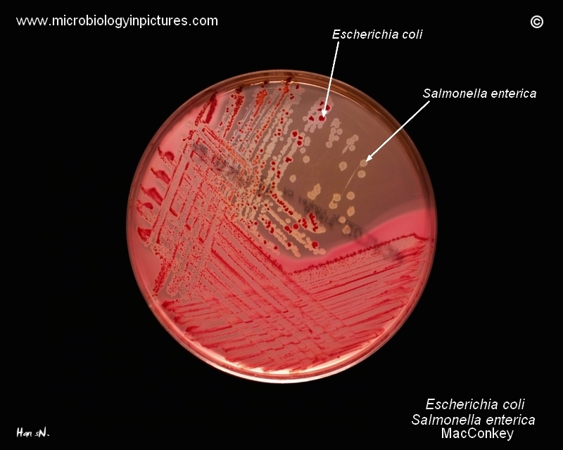 E.coli, S.enterica