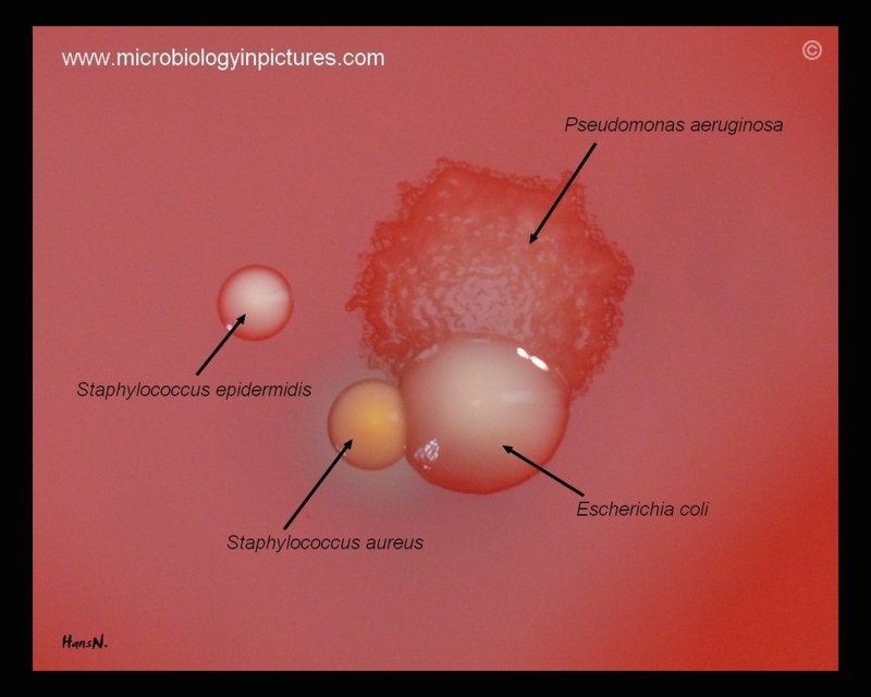 staphylococcus epidermis epidermidi