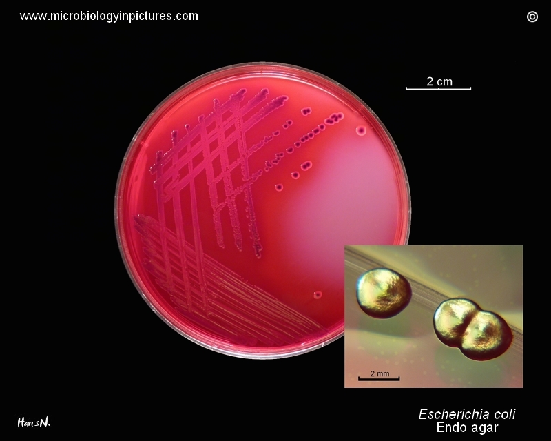 E.coli, metallic