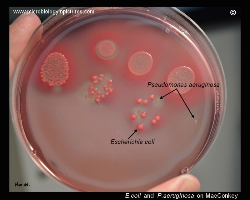 pseudomonas aeruginosa on macconkey agar