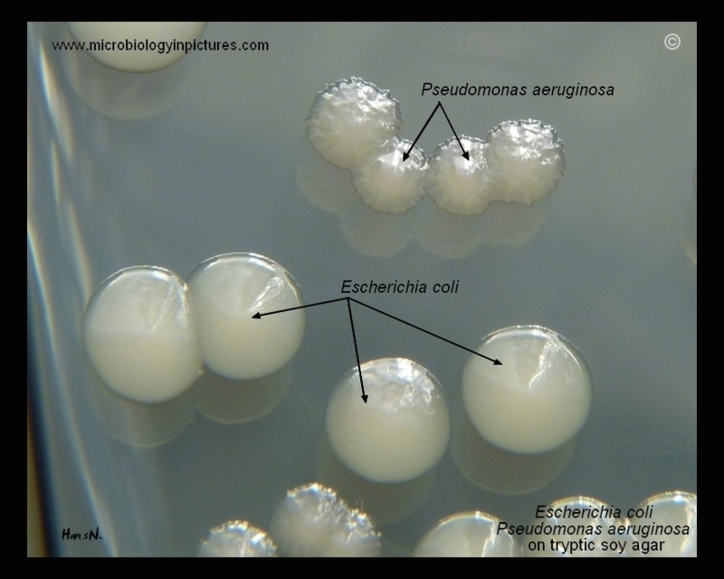 Detail Of E Coli And Pseudomonas Aeruginosa On Tryptic Soy Agar Tsa