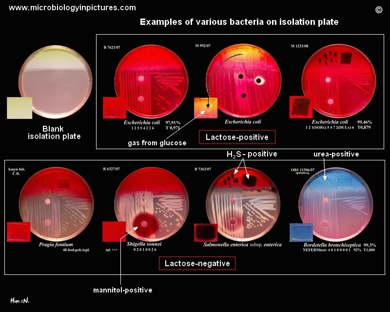 preliminary identification of bacteria