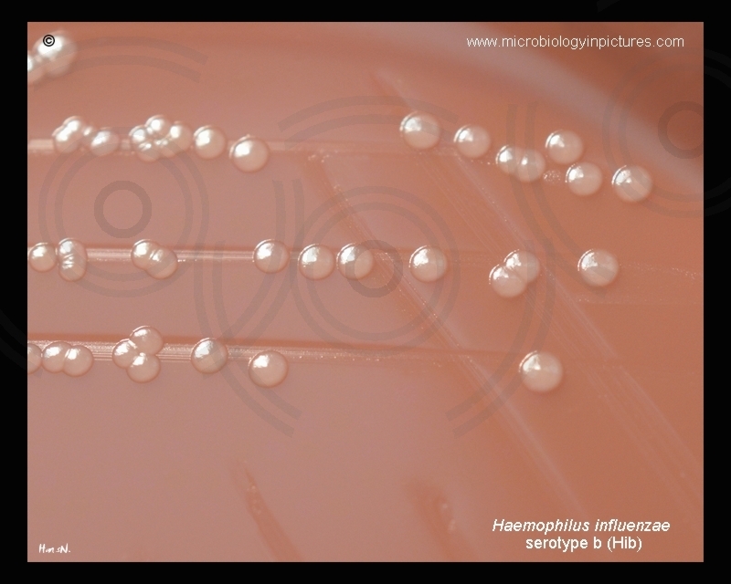 group b Haemophilus influenzae