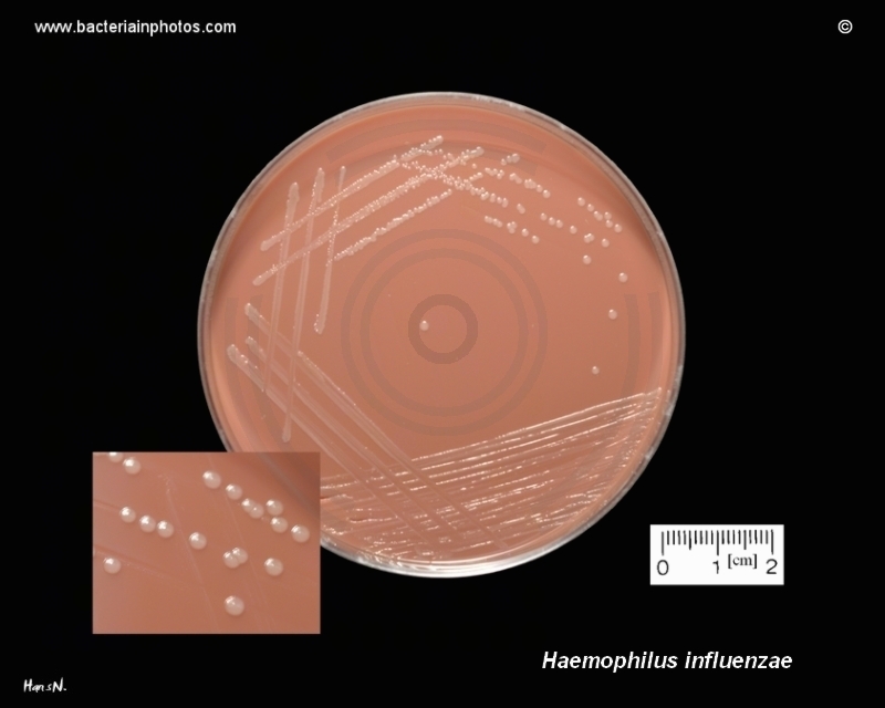 chocolate agar plate