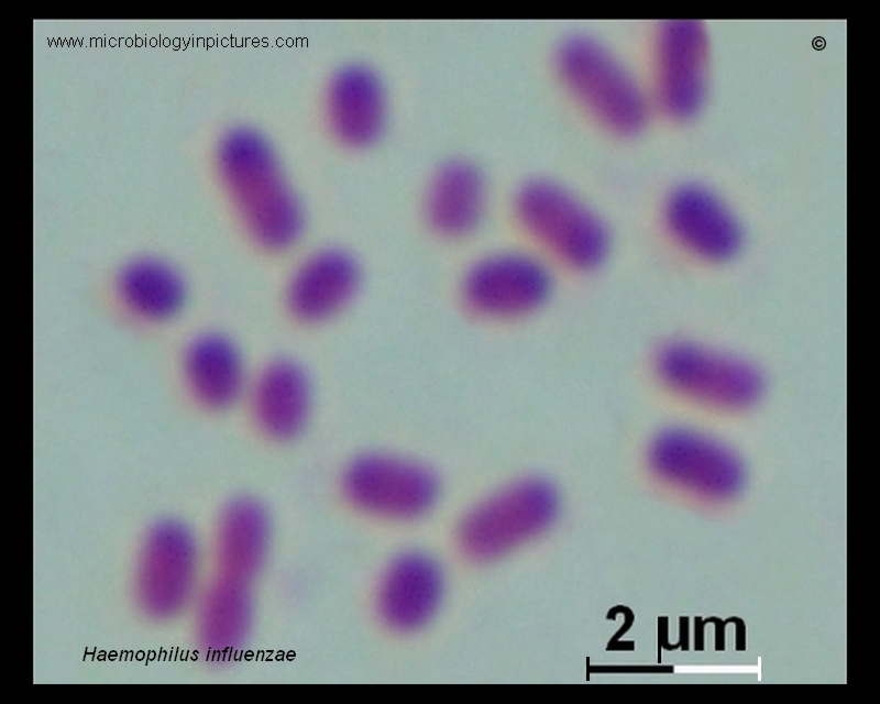 H.influenzae micrograph