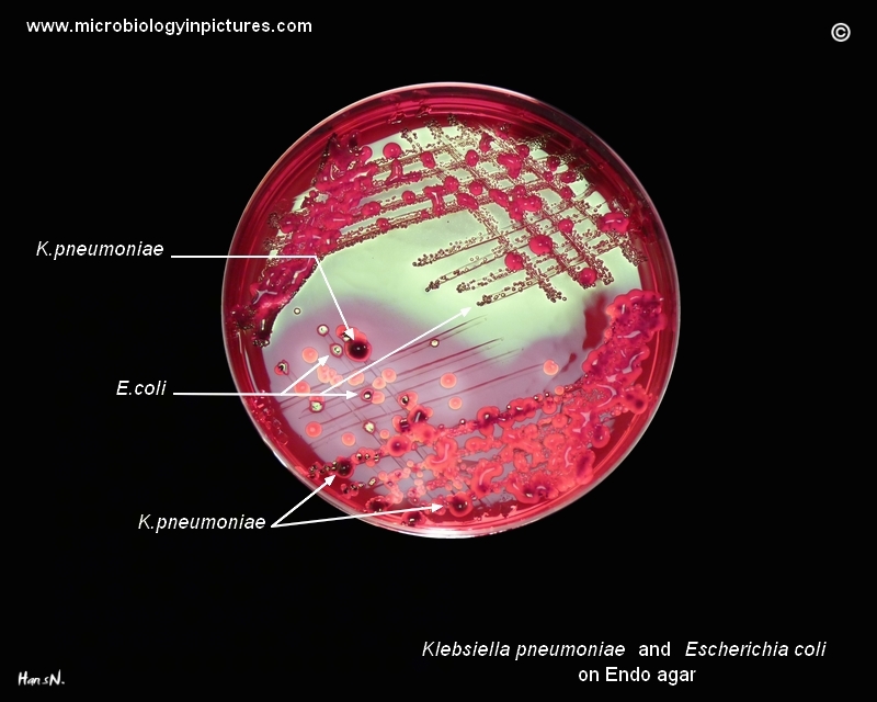 Klebsiella pneumoniae, E.coli on Endo