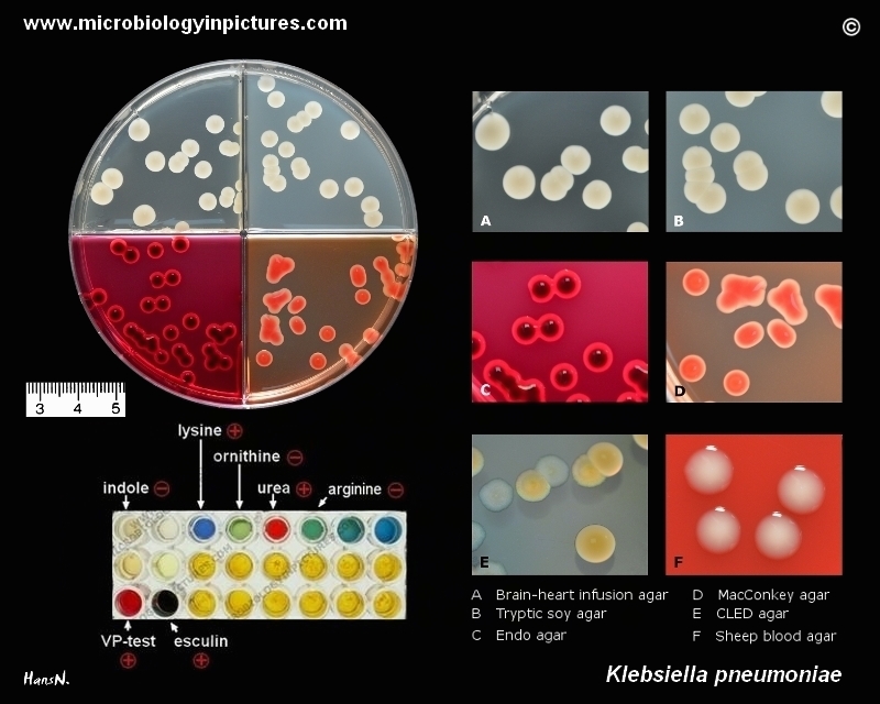 klebsiella szag a szájból