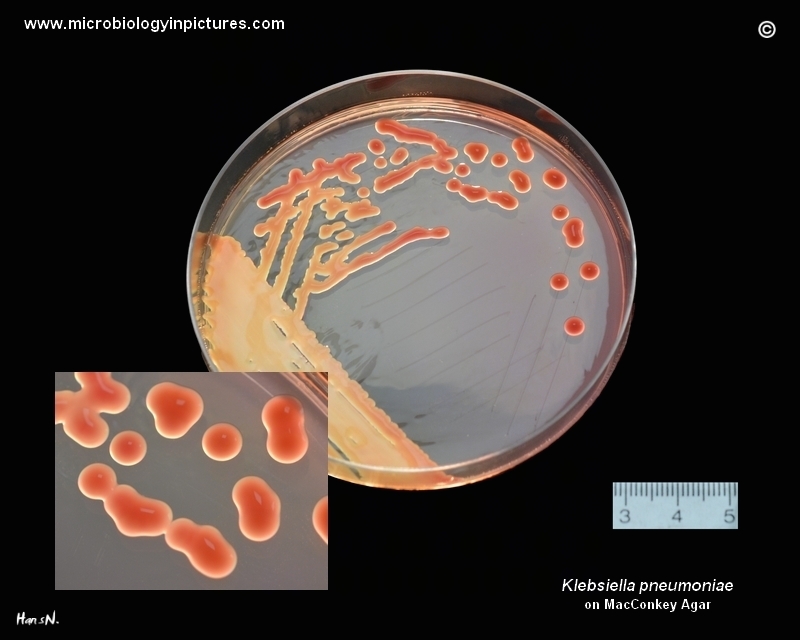 K.pneumoniae on MacConkey in Petri dish