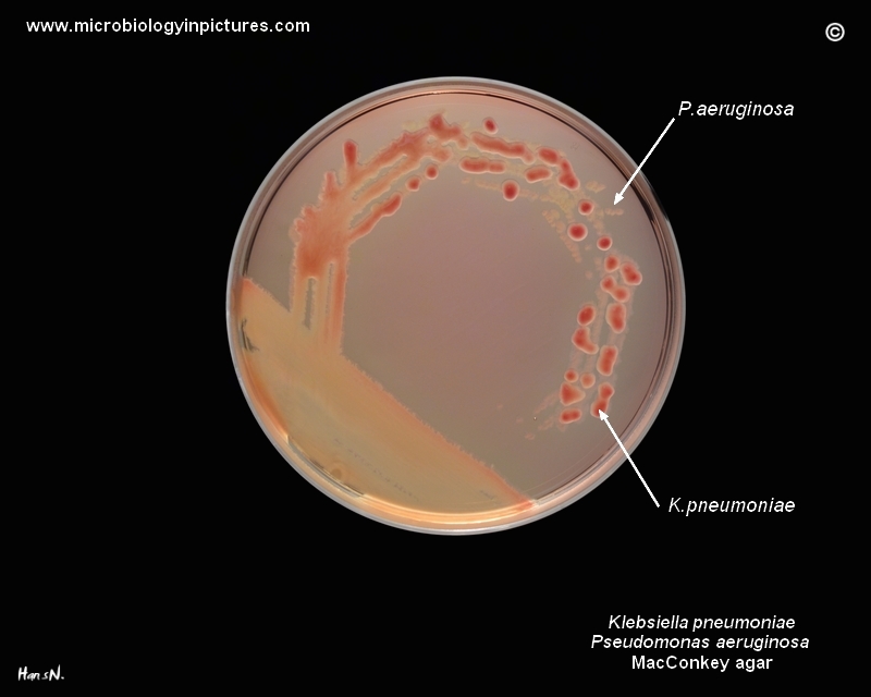 K.pneumoniae and P.aeruginosa on MacConkey in Petri dish