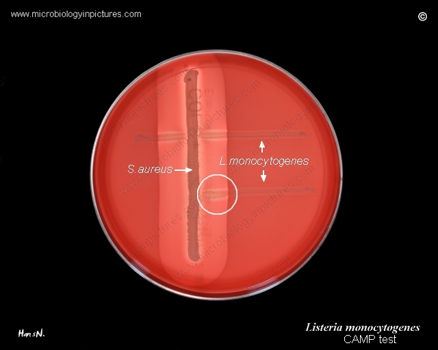 Listeria monocytogenes CAMP test