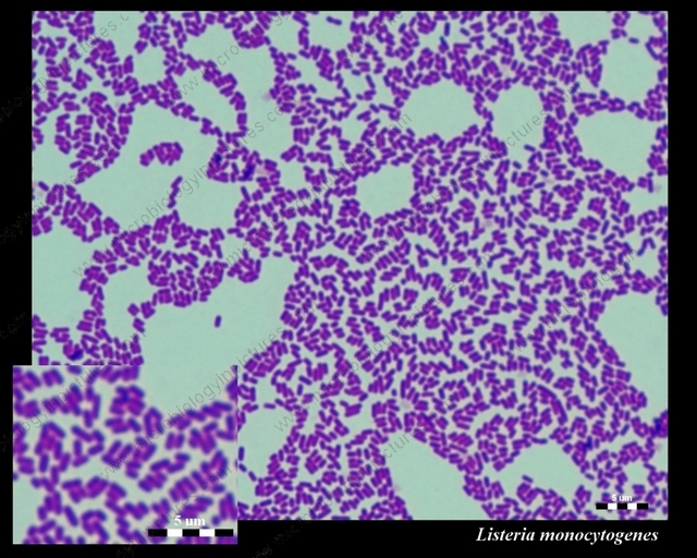 listeria monocytogenes micrograph