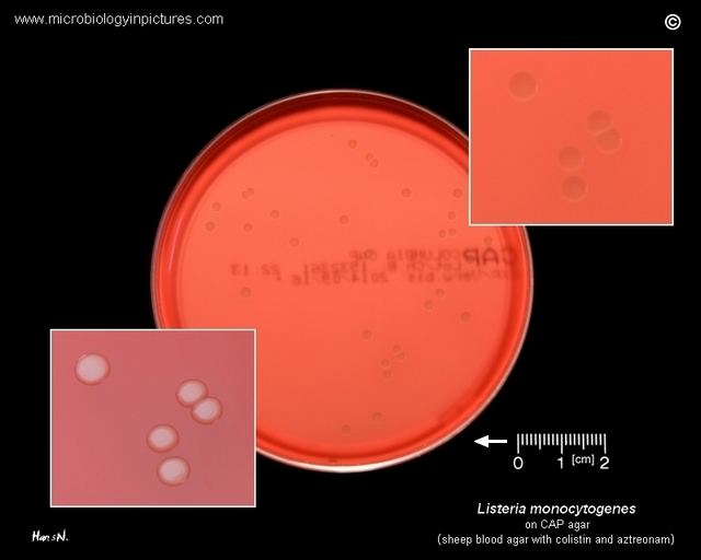 listeria monocytogenes growing on agar plate with sheep blood and antibiotics