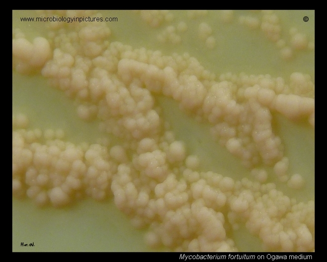 mycobacterium fortuitum colonies on Ogawa medium