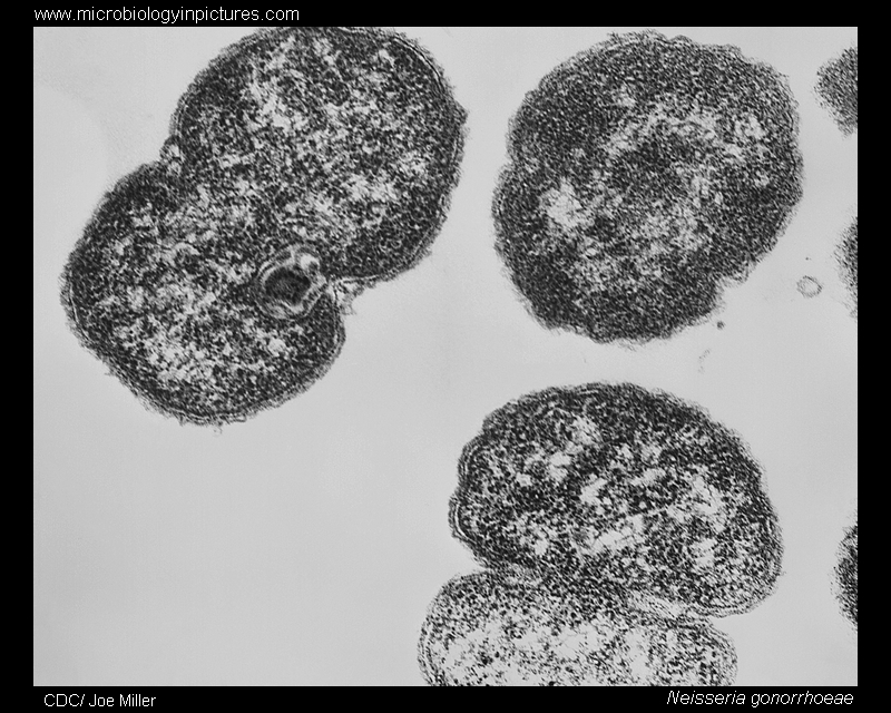 Neisseria gonorrhoeae TEM Neisseria gonorrhoeae TEM