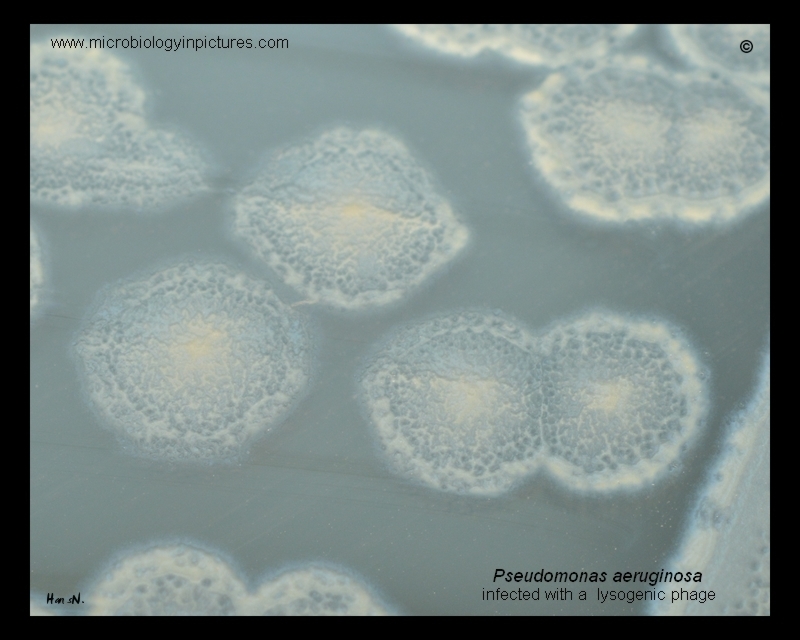 lytic changes on bacterial colonies of Pseudomonas aeruginosa