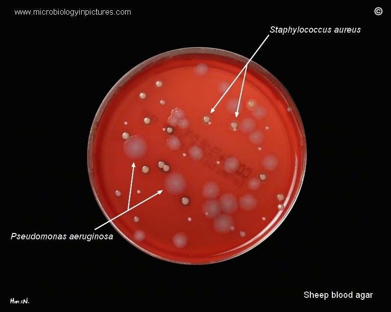 pseudomonas aeruginosa bacteria in Petri dish