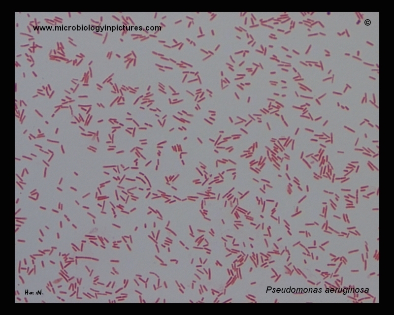Pseudomonas aeruginosa micrograph