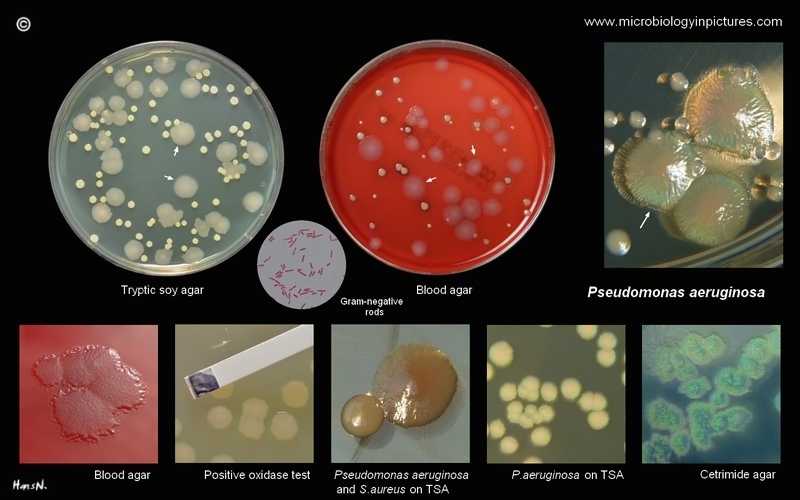 pseudomonas aeruginosa on macconkey agar