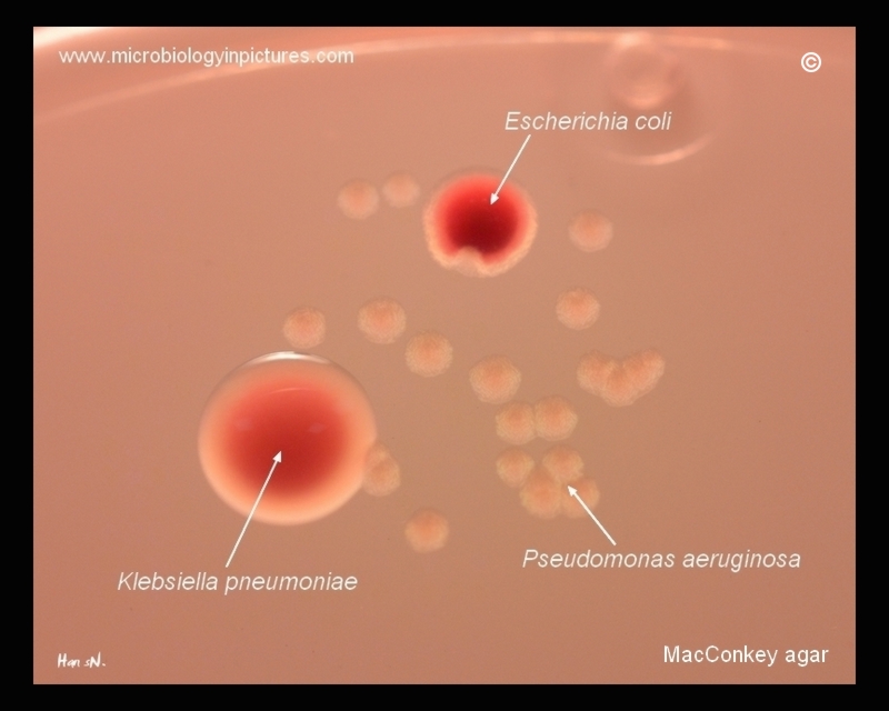 pseudomonas aeruginosa on macconkey agar