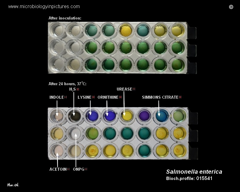 Biochemical identification of Salmonella with a commercial kit identification of salmonella