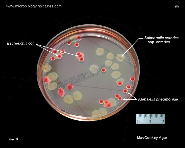 macconkey agar salmonella