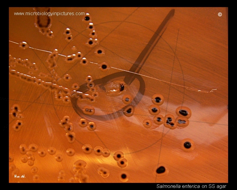 salmonella shigella agar, SS agar