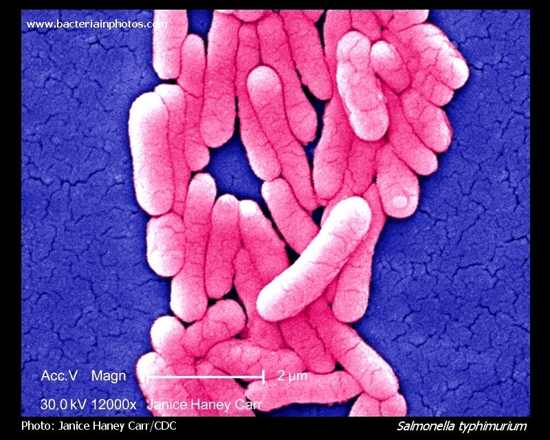 salmonella typhimurium, scanning electron micrograph, SEM