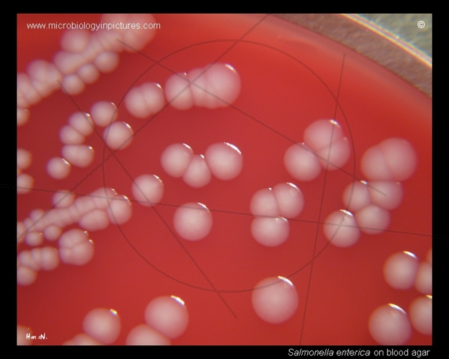 salmonella colonies on sheep blood agar