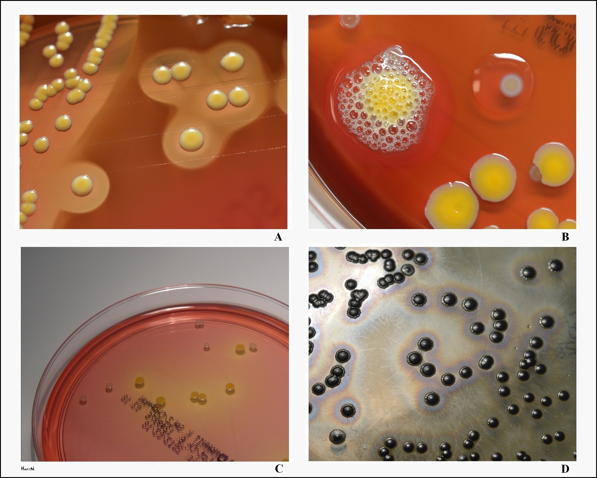 s. aureus growth under anaerobic conditions, catalase test, growth on selective media