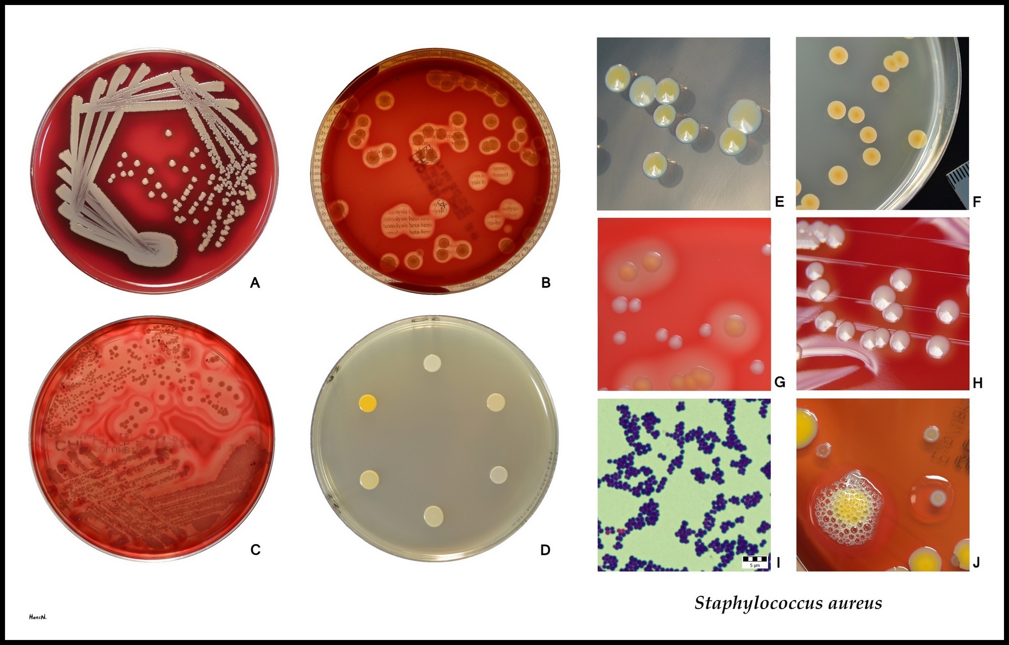 Staphylococcus aureus photo.