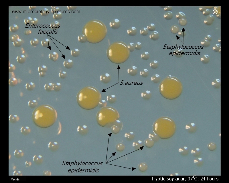 staphylococcus epidermis epidermidi