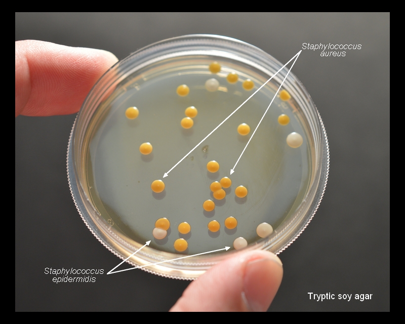 staphylococcus epidermis epidermidi