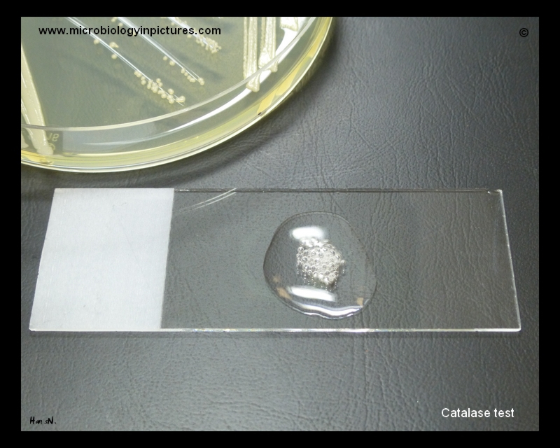 Staphylococcus epidermidis catalase test catalase positive s.epidermidis