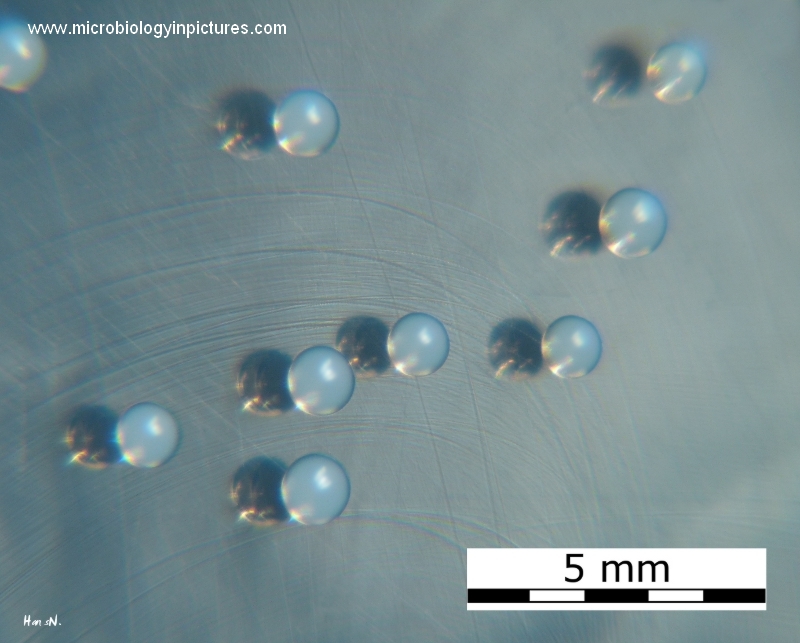 Staphylococcus epidermidis on TSA (tryptic soy agar) s.epidermidis colony morphology on agar