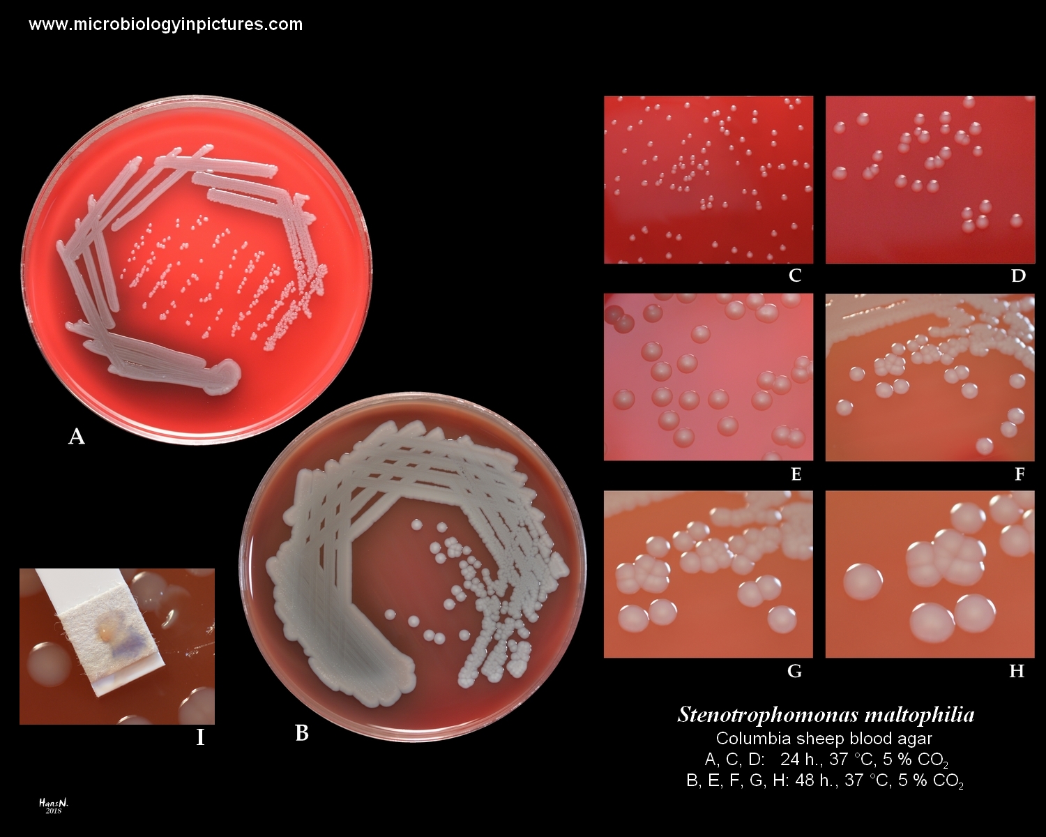 stenotrophomonas maltophilia growth on blood agar