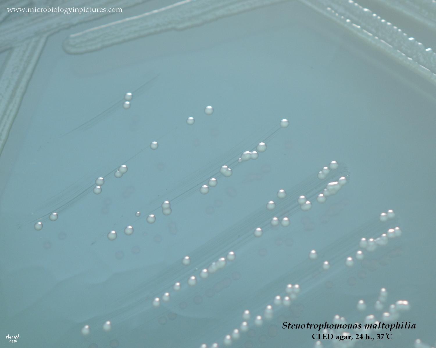 stenotrophomonas maltophilia on CLED