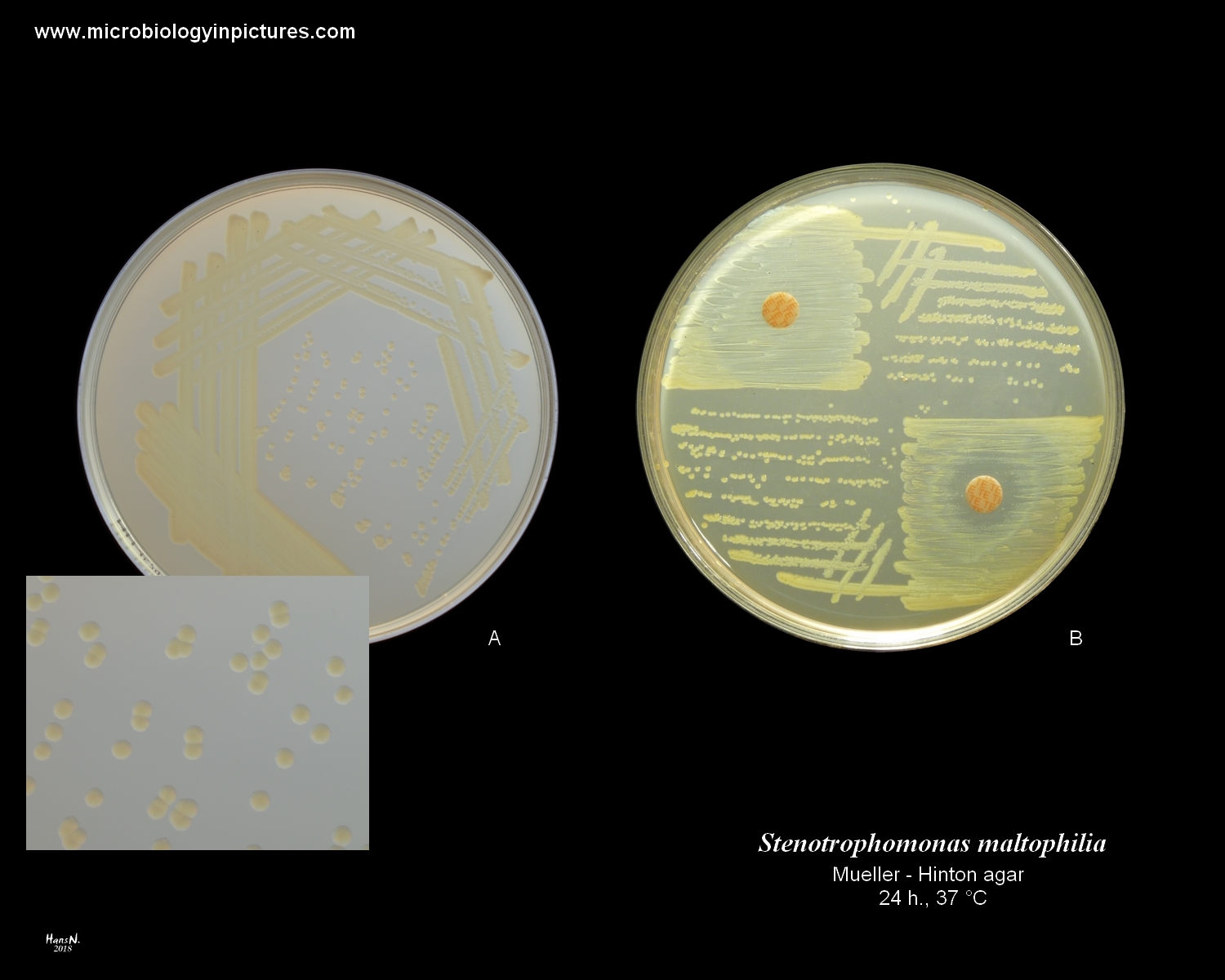 stenotrophomonas maltophilia yellow color of colonies