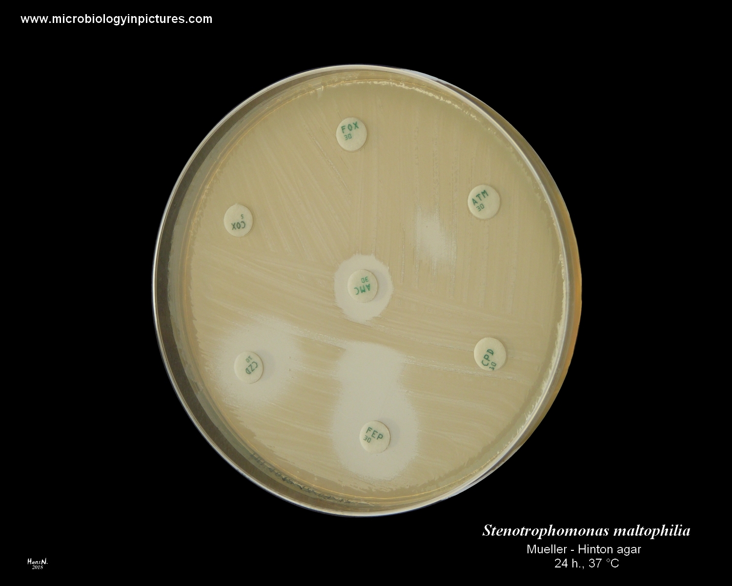 stenotrophomonas maltophilia amoxicillin - clavulanic acid
