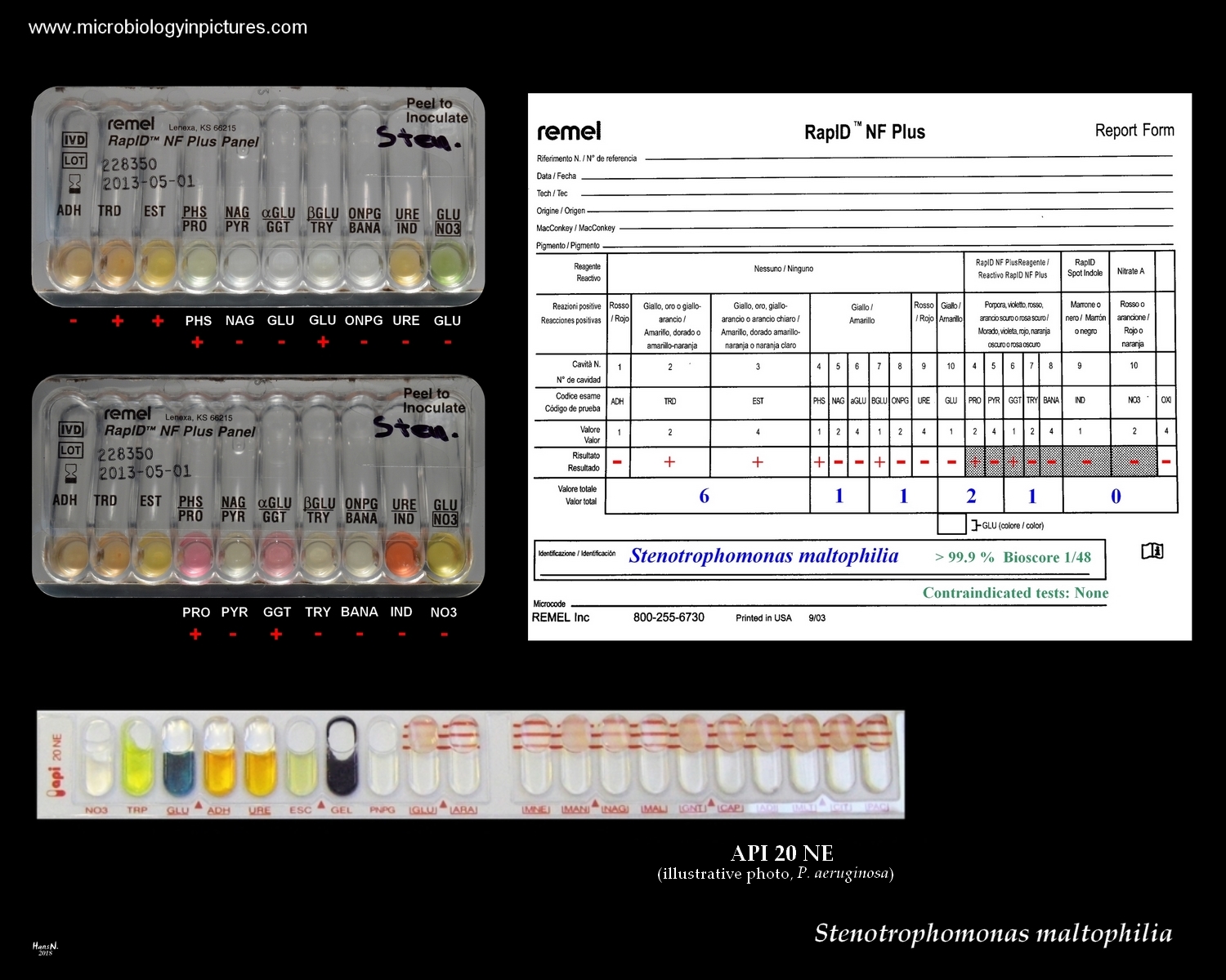 stenotrophomonas maltophilia biochemical identification