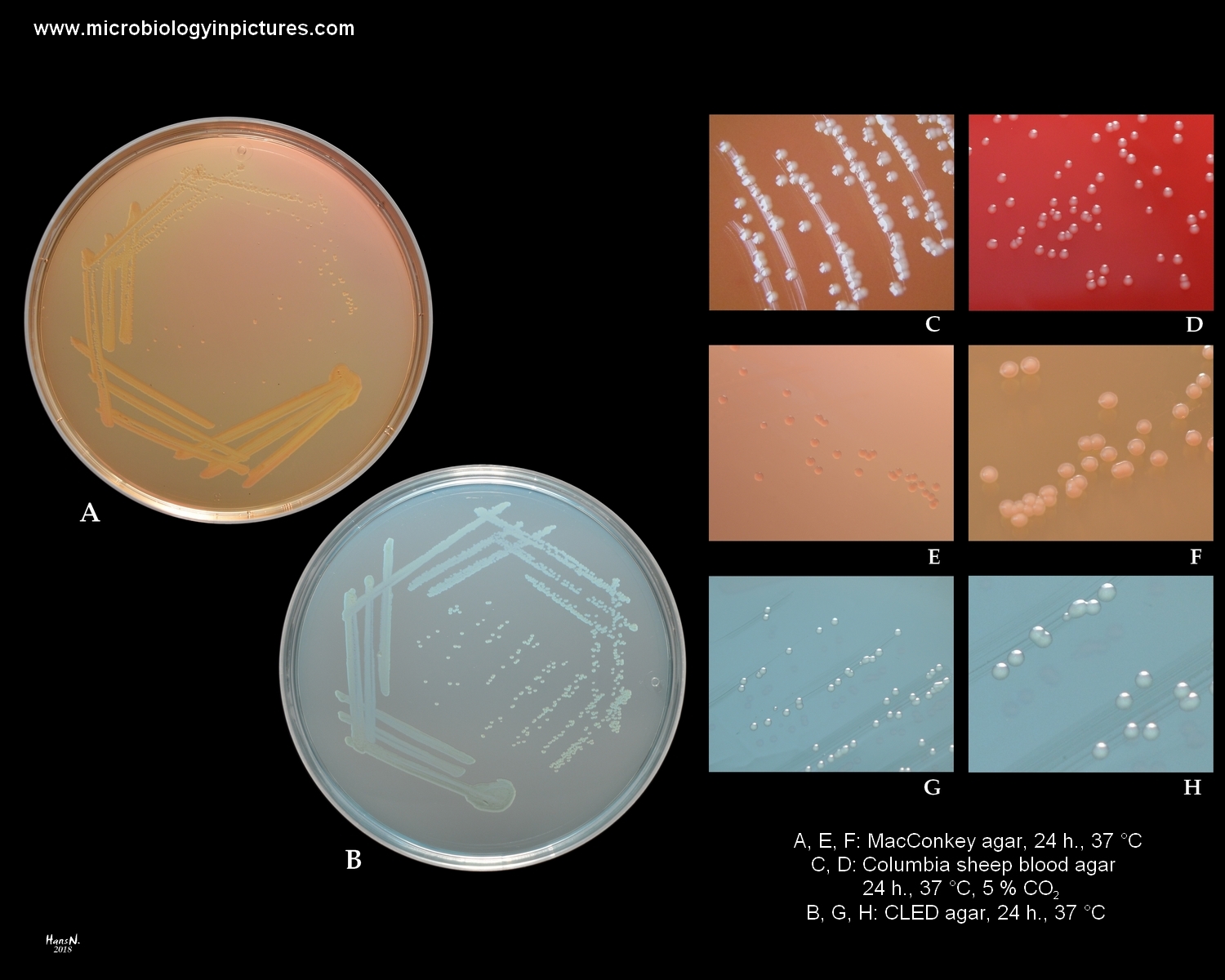 stenotrophomonas maltophilia on MacConkey and CLED agar