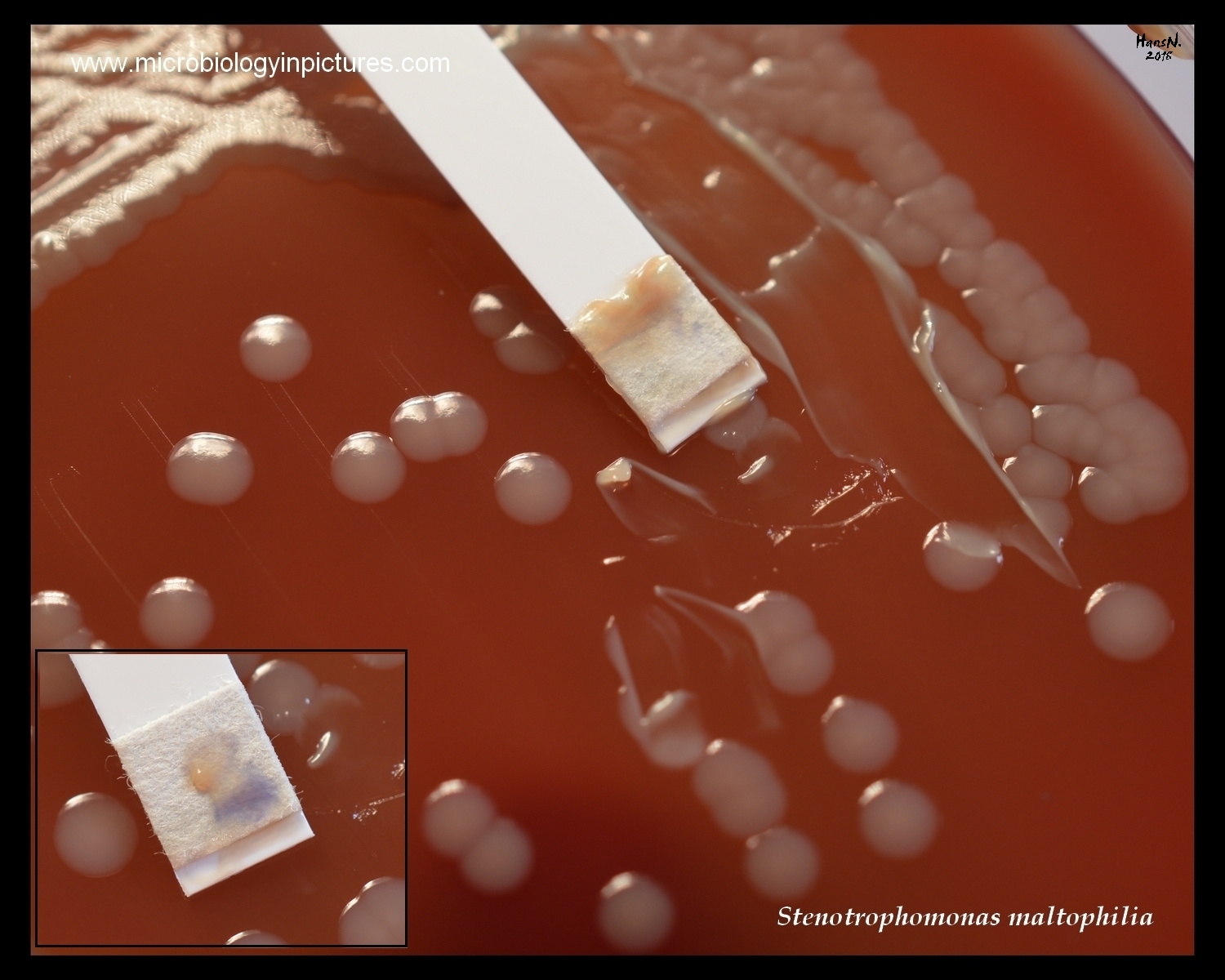 stenotrophomonas maltophilia oxidase test