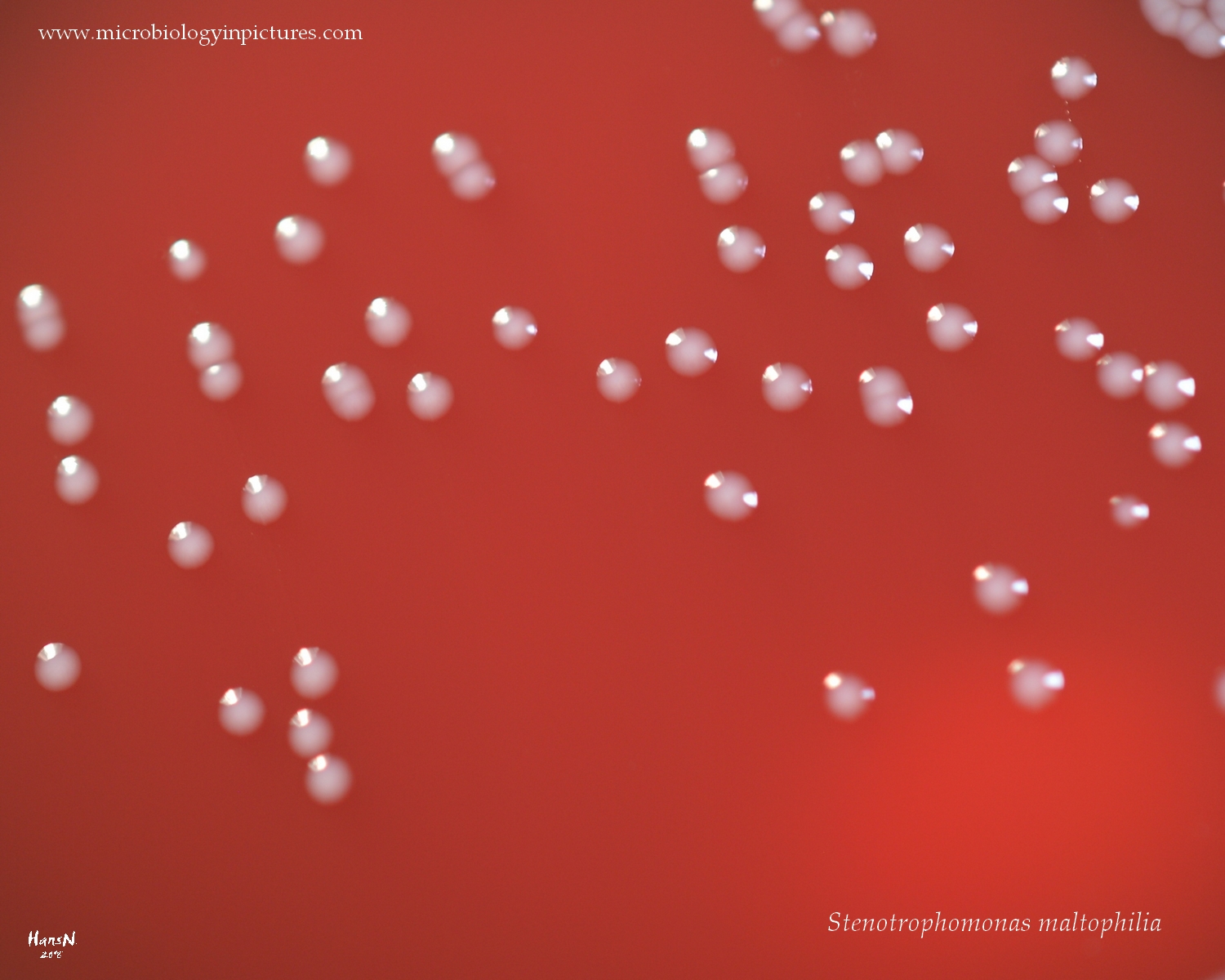 stenotrophomonas maltophilia colony morphology