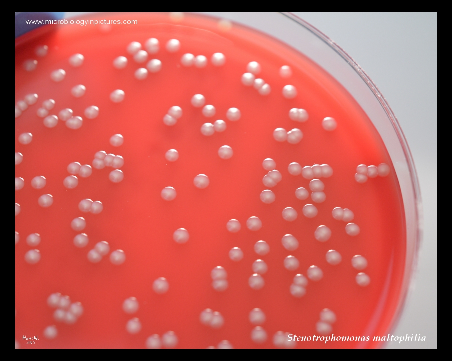 stenotrophomonas maltophilia oxidase test