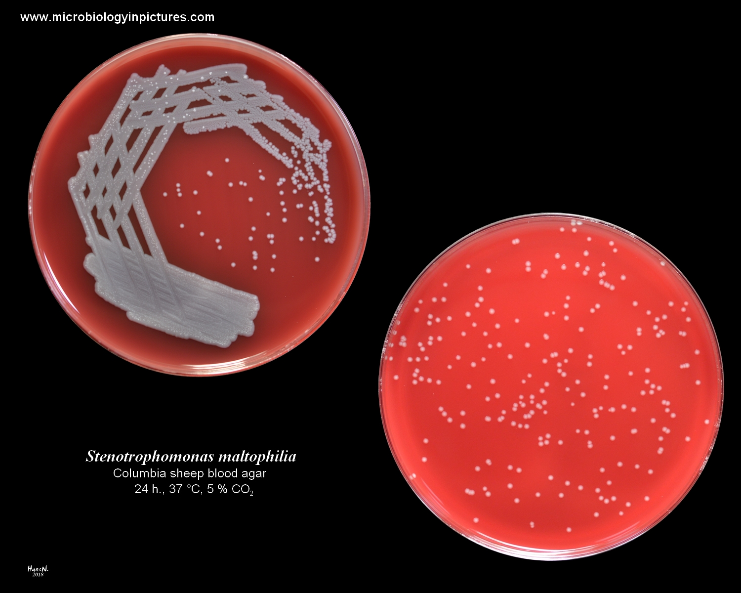 s. maltophilia on agar