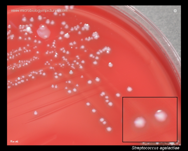 Стрептококки у женщин лечение. Streptococcus pyogenes на кровяном агаре. Стрептококкус агаре стрептококк на кровяном. Колонии стафилококка на кровяном агаре. Стрептококк агалактия на кровяном агаре.