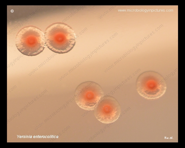 growth of y.enterocolitica colonies on macconkey, colony morphology
