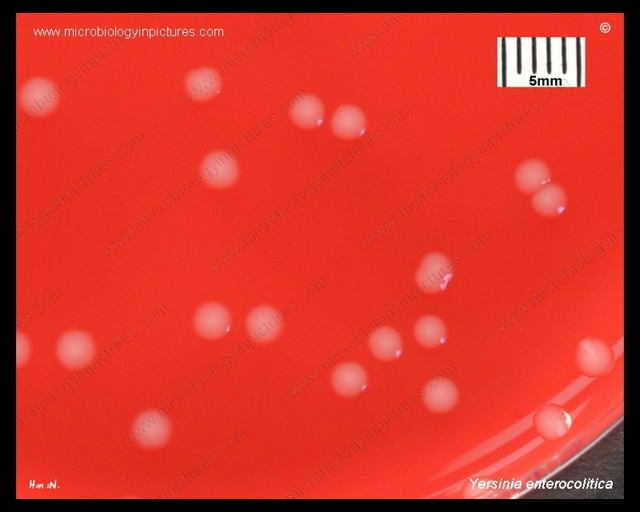 y.enterocolitica colony morphology on blood agar